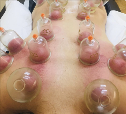 Restore balance with the power of Traditional Chinese Medicine.