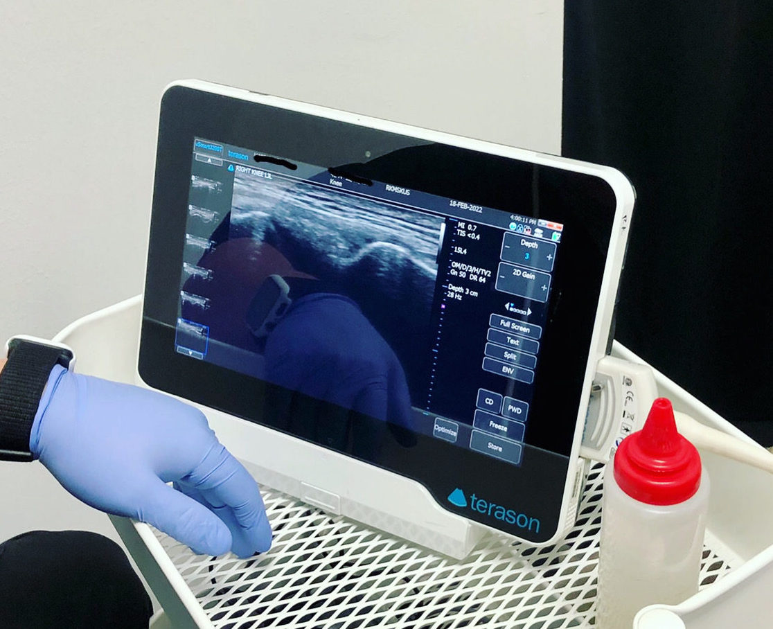 Musculoskeletal Ultrasound Longevity Medicine Sports Therapy Musculoskeletal Ultrasound Longevity Medicine Sports Therapy